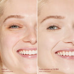 Before and after comparison of a woman's smile with cosmetic effects applied. [1.0 BH]