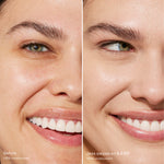 Before and after comparison of a woman's smile [5.0 EP]
