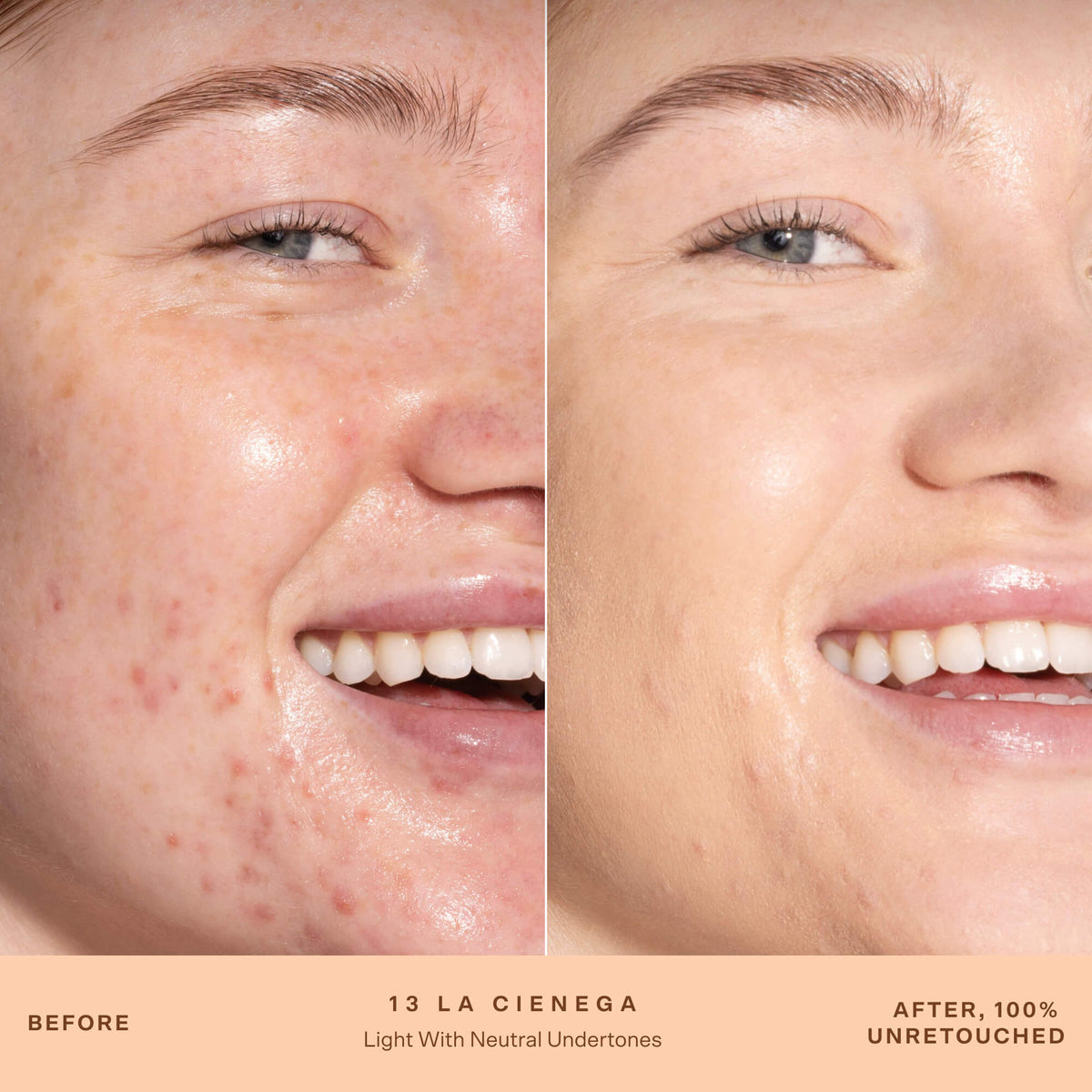 A person's face before and after applying SunnyDays™ Tinted SPF 30 in the shade 13 La Cienega, revealing sheer, buildable coverage that visibly evens skin tone and softens discoloration while maintaining a natural, skin-like finish. [13 La Cienega]