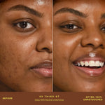 A person's face before and after applying SunnyDays™ Tinted SPF 30 in the shade 60 Third St, revealing sheer, buildable coverage that visibly evens skin tone and softens discoloration while maintaining a natural, skin-like finish. [60 Third St]