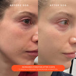 A comparison before and after the use of Tower 28 Beauty SOS Recovery Cream. "Increased hydration after 4 days. Clinically proven to increase hydration." [Shared]