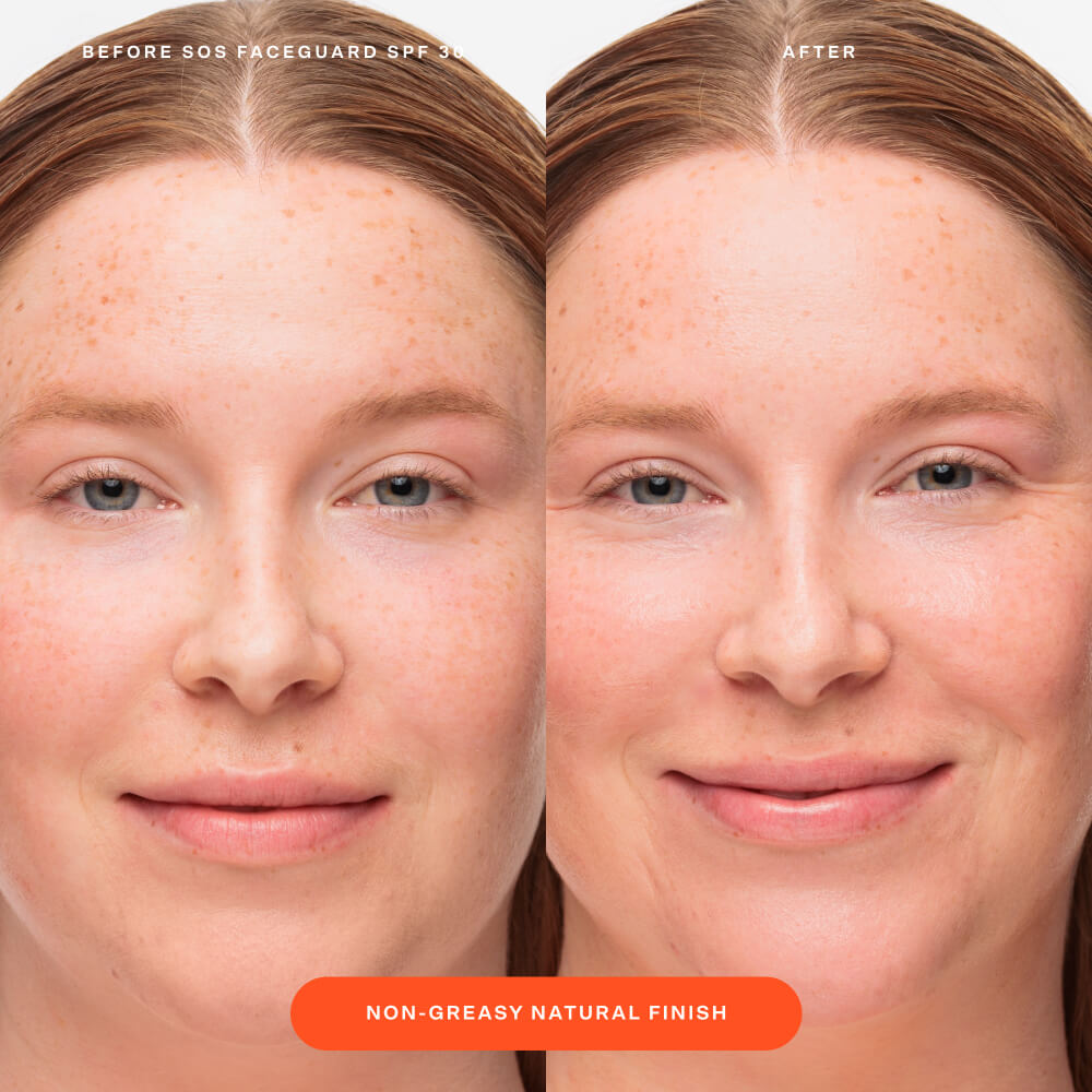 Before and after comparison of a person’s face shows the visible results of applying Tower 28 Beauty’s SOS FaceGuard SPF 30, highlighting a non-greasy, natural finish and more even-looking skin.  [Shared: SOS FaceGuard SPF 30]