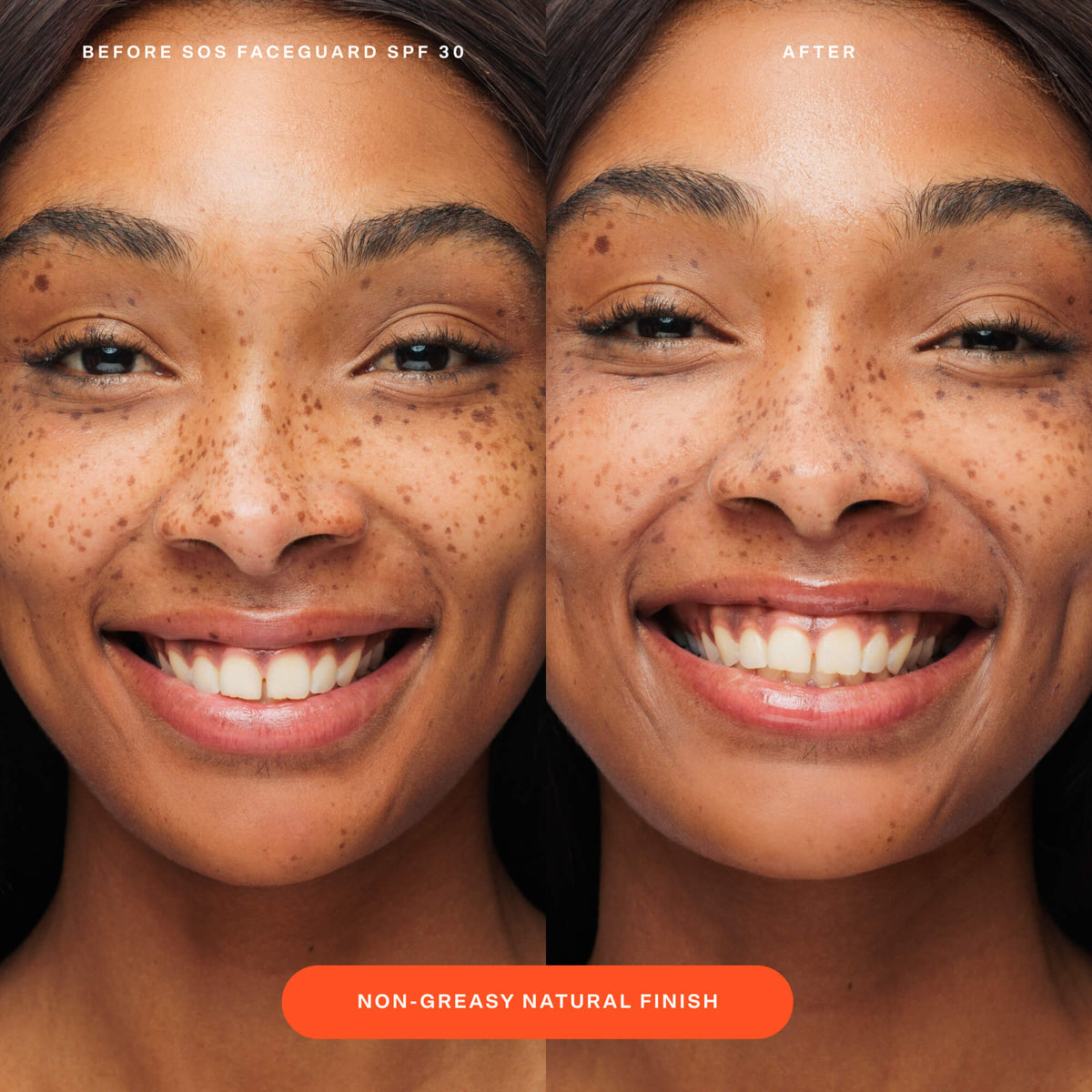 Before and after comparison of a person’s face shows the visible results of applying Tower 28 Beauty’s SOS FaceGuard SPF 30, highlighting a non-greasy, natural finish and more even-looking skin.  [Shared: SOS FaceGuard SPF 30]
